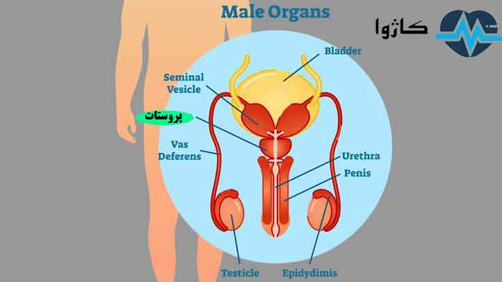 بیماری پروستات