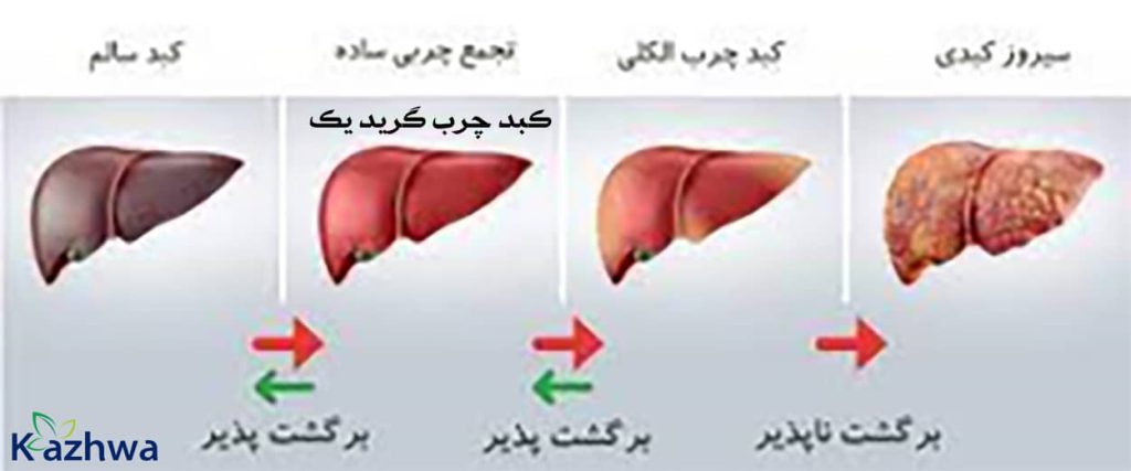 داروی گیاهی چربی کبد گرید یک