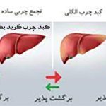 داروی گیاهی چربی کبد گرید یک