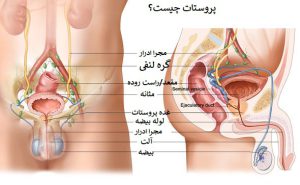 درمان گیاهی پروستات