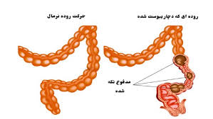 داروی یبوست کاژوا